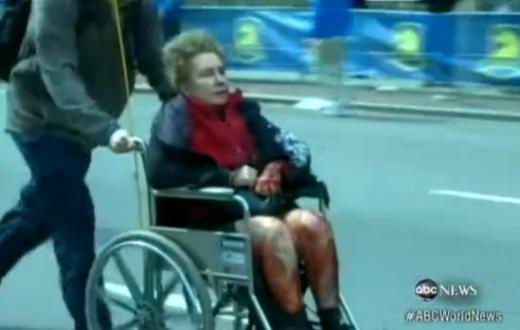 ↑보스턴 마라톤 국제대회 폭탄 테러 직후 이송되는 부상자. (ⓒABC뉴스 동영상 캡처)