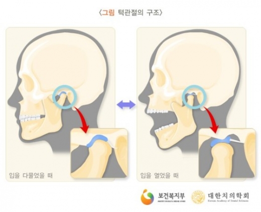 턱 관절 구조(그림=보건복지부, 대한치의학회)