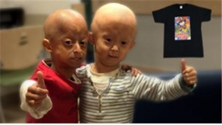 '소비로 기부하기' 첫 번째 프로젝트로 소아조로증 환자 홍원기 군(사진 오른쪽)을 돕는 티셔츠를 판매했다/사진제공=쉐어앤케어