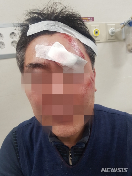 지난 22일 더불어민주당 소속 최재성 강북구의원에게 폭행 당한 동장 조모(59)씨 모습. /뉴시스=독자제공