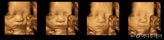 삼성메디슨 'WS 80'으로 촬영한 태아의 모습/사진제공=삼성메디슨