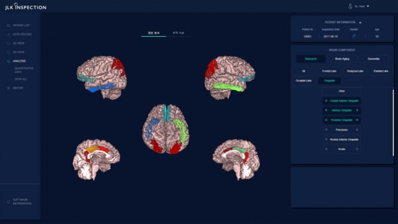 에이트로스캔 뇌 MRI(자기공명영상) 분석 화면/사진=제이엘케이인스펙션 