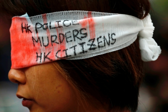 '홍콩 경찰이 홍콩 시민을 죽이고 있다'는 글귀가 새겨진 붕대를 감은 한 홍콩 시민. /사진=로이터통신