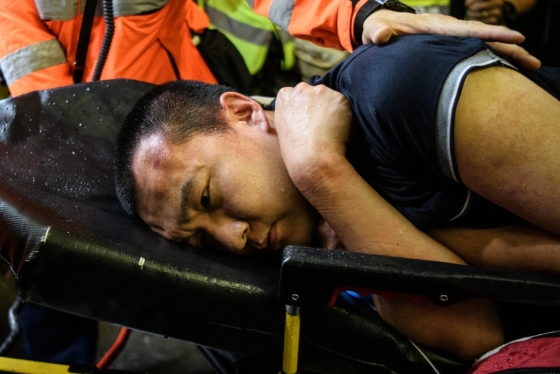 13일(현지시간) 홍콩국제공항에서 잠복 경찰로 의심을 받아 시위대에 억류됐던 남성이 부상을 입고 구조요원에 의해 이송되고 있다. /사진=AFP