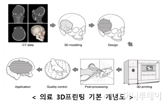 의료 3D 프린팅 기본 개념도/사진제공=과학기술정보통신부