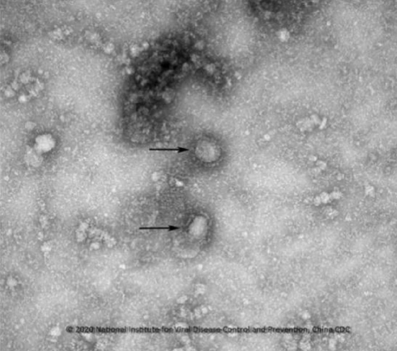 중국 우한 코로나바이러스 전자현미경 사진 / 사진제공=질병관리본부