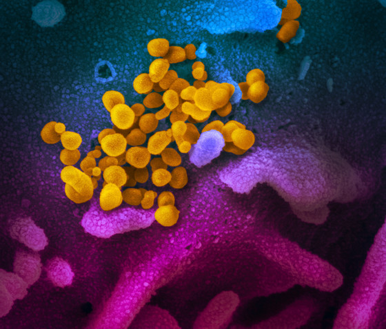 미국 코로나19 감염 환자의 상피세포에서 추출, 실험실에서 배양된 바이러스 모습(노란색 부분)© 미국 국립 알레르기·전염병 연구소 로키마운틴 실험실 (NIAID-RML)