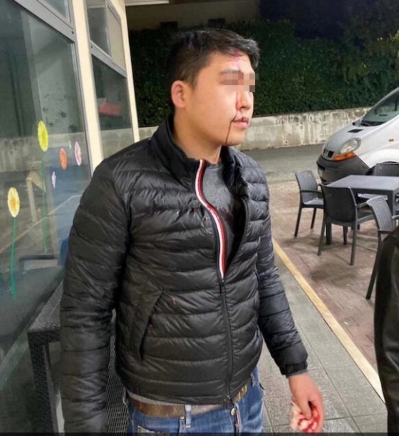이탈리아에서 한 중국계 남성이 술집에 들어가 "코로나19 감염자는 들어올 수 없다"는 얘기를 듣고 유리병으로 머리를 맞는 일이 발생했다. <출처=이탈리아 일메세그로 갈무리>