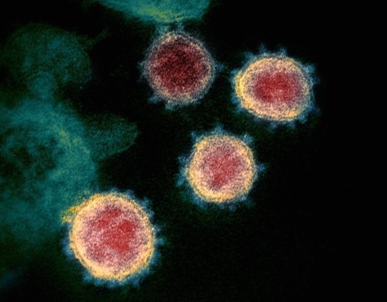 신종 코로나바이러스(2019-nCoV) 전자현미경 촬영 사진 © 미국 국립 알레르기·전염병 연구소 로키마운틴 실험실 (NIAID-RML)