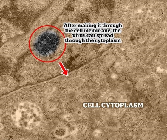 코로나바이러스(빨간 원)가 세포 내부에 들어간 후의 사진. 세포핵 접근을 시도하고 있다. /사진 = 오스왈도 크루즈 재단