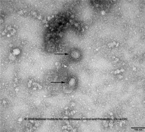 코로나19(신종 코로나바이러스 감염증) 바이러스 전자현미경 사진/사진=질병관리본부