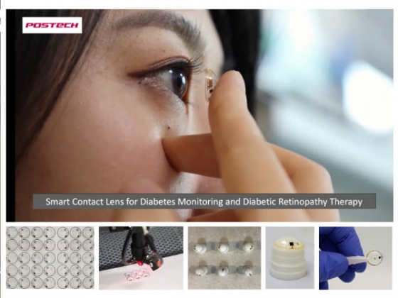 포스텍 연구진이 개발한 당뇨 진단·치료용 스마트 콘택트렌즈/사진=포스텍