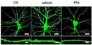 PPA 에 영향을 받은 해마 뉴런의 수상돌기 가시가 감소/사진=한국뇌연구원