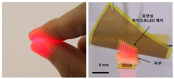 (좌측)생체 조직(손가락)을 통과하는 마이크로LED의 적색광 사진,     (우측)유연성 마이크로LED 패치에서 피부를 통해 빛을 조사하는 사진/자료=GIST