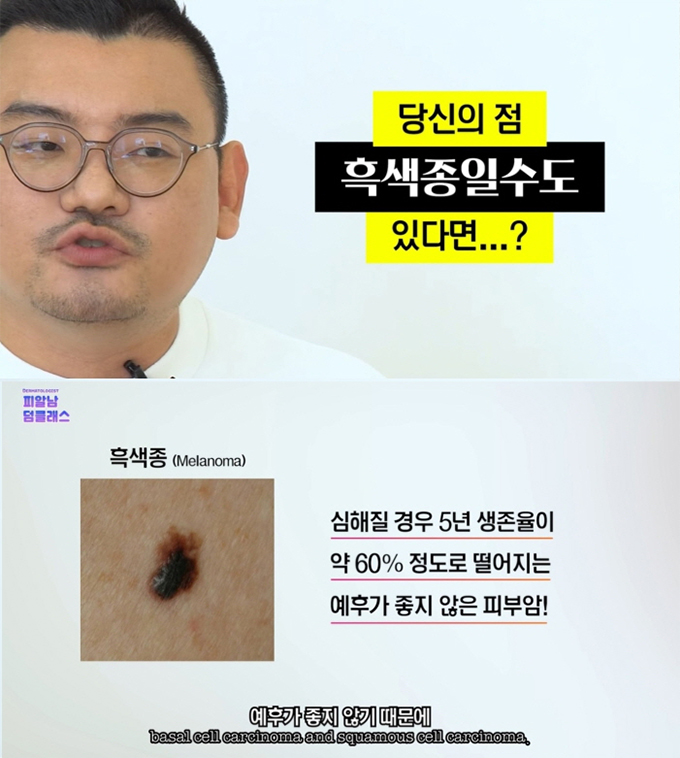 /사진=유튜버 '피알남 피부과전문의 김홍석' 영상 캡처