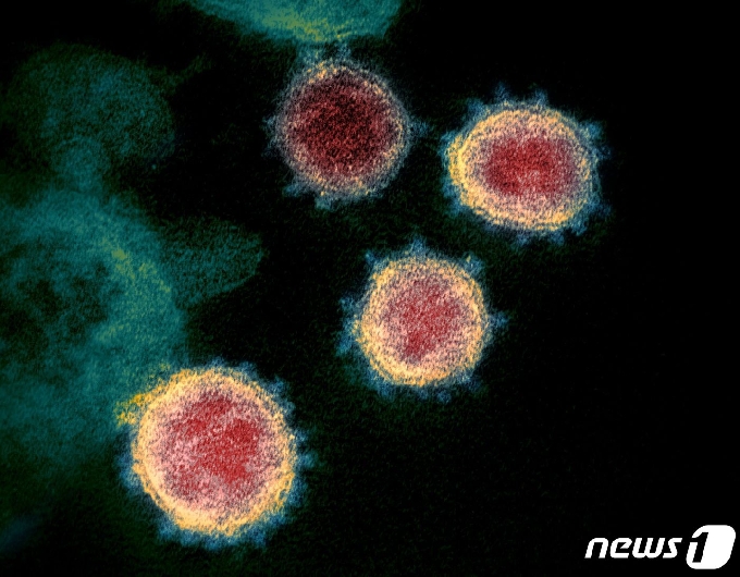 전자현미경으로 촬영한 신종 코로나바이러스 © AFP=뉴스1