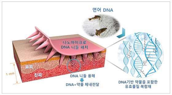 통증없이 붙이는 주사-나노마이크로 DNA 니들패치/자료=기계연