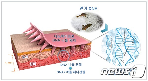 통증 없이 붙이는 주사-나노마이크로 DNA 니들패치© 뉴스1