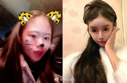 저우추나(16)의 성형하기 전 모습과 수술 이후 모습. 웨이보 캡처.