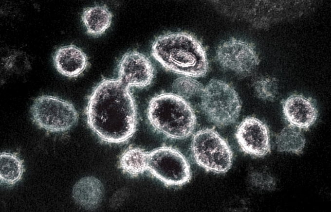 현미경으로 들여다 본 신종 코로나바이러스(SARS-CoV-2) 이미지. 미 국립보건연구소(NIH) 제공/사진=AFP