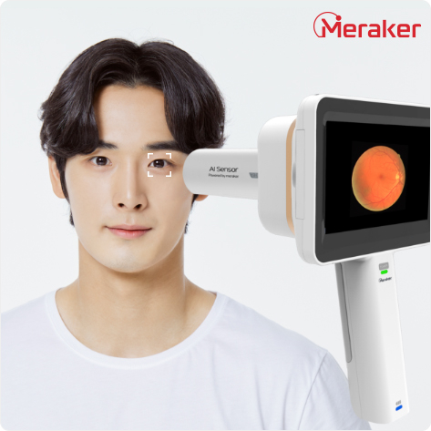 메라커의 AI 센서 기술이 적용된 '휴대형 안저카메라'/사진=한국전기연구원 