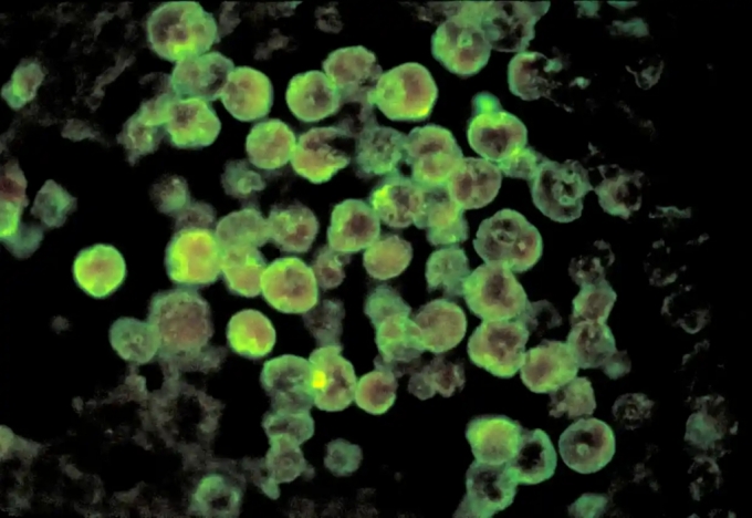 뇌 먹는 아메바로 알려진 '네글레리아 파울러리'를 현미경으로 본 모습 /사진=미국 CDC