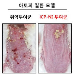 면역 염증 치료 신약 'iCP-NI'를 아토피피부염 질환모델에 피하주사(SC) 투여한 결과, 피부 표면이 각질화가 회복되면서 아토피피부염이 치료된 결과를 보여주고 있다. /사진제공=셀리버리