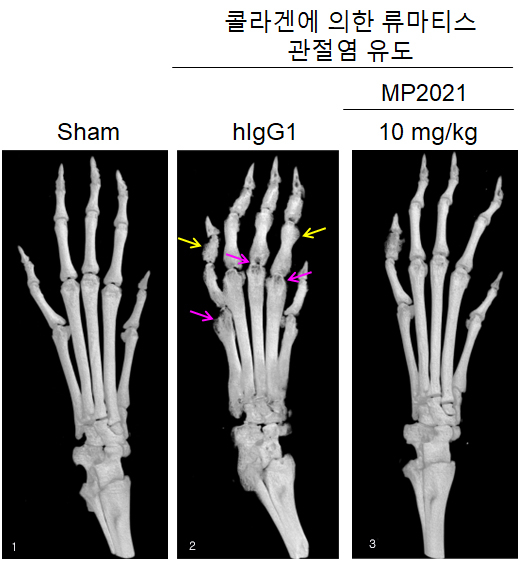 메드팩토의 뼈 질환 치료제 후보물질 'MP2021'의 동물실험 관련 사진. (왼쪽)정상 쥐의 다리 뼈 사진. (가운데)콜라겐에 의해 류마티스 관절염이 유도된 쥐의 다리 뼈 사진. (오른쪽)류마티스 관절염이 유도된 쥐에 MP2021을 투여한 후 쥐의 다리 뼈 사진. MP2021 투여 뒤 뼈의 부기가 빠지고 소실이 회복된 모습을 확인할 수 있다. /사진제공=메드팩토