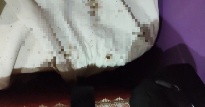  서울의 한 모텔에서 진드기와 빈대가 발견됐다는 한 투숙객의 주장이 제기됐다. /사진=보배드림
