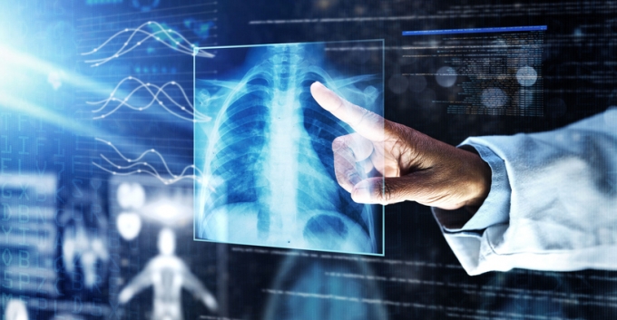 AI, 이제 CT 사진으로 폐활량까지 예측…COPD 진단 정확도 '90%'