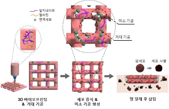 3D 바이오프린팅 NK 세포의 면역 치료 과정