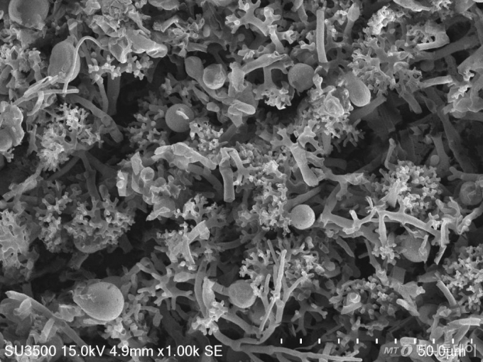 인삼특작부 버섯과 안기홍 박사 연구팀은 전자현미경 관찰을 통해 균사체의 구조적 특성을 분석하고 이를 통해 소재화 가능 균주를 선발했다. 사진은 결합균사형태.