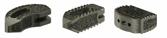 오스테오닉, 3D 프린팅 티타늄 척추 임플란트 출시
