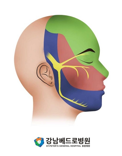 삼차신경통을 일으키는 신경 범위(노란색) / 그림=강남베드로병원