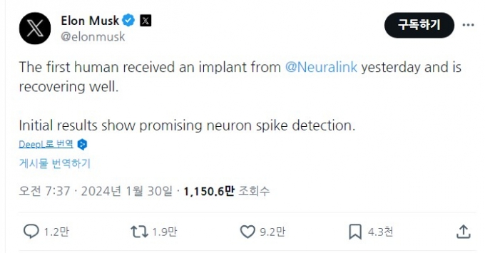 '뇌-컴퓨터 연결 시대' 오나…머스크 "인간 뇌에 칩 이식 성공"