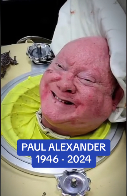 소아마비로 72년간 철제 산소통 기계 '아이언렁'에서 지냈던 미국 남성 폴 알렉산더가 78세로 별세했다./사진=폴 알렉산더 틱톡 캡처