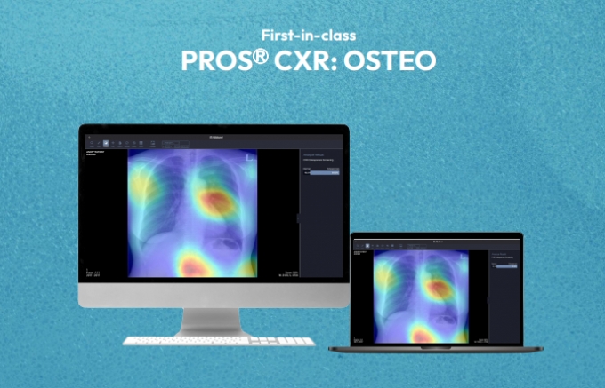 프로메디우스의 엑스레이 기반 골다공증 분석 AI 솔루션 &#039;PROS(R) CXR: OSTEO&#039;/사진제공=프로메디우스