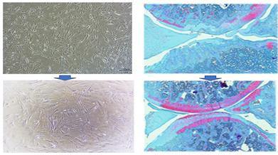 신경 전구줄기세포로의 분화(사진 왼쪽)와 연골전구줄기세포를 활용한 관절염 회복 사진/사진제공=스마트셀랩