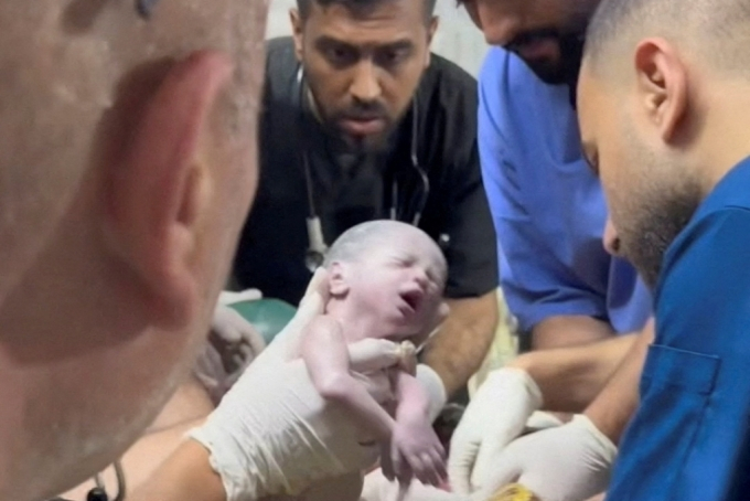 이스라엘의 가자지구 공격으로 숨진 팔레스타인 임산부의 배 속에 있던 아기가 응급 제왕절개 수술로 태어났다. /로이터=뉴스1
