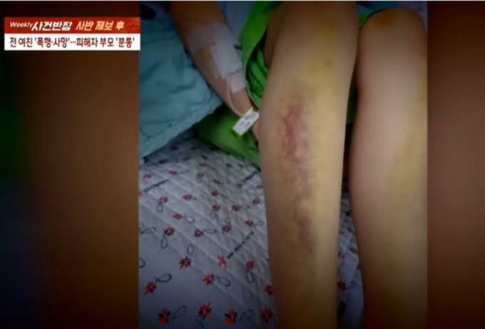 경남 거제에서 연인 관계였던 20대 남성에게 폭행을 당해 사망한 피해자./사진=JTBC 캡처)