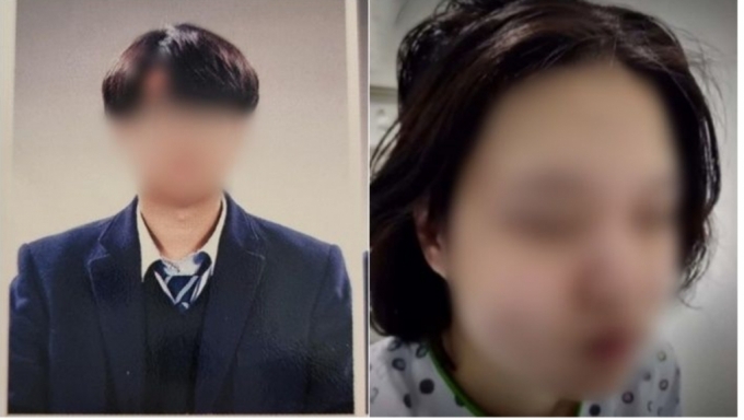 (왼쪽부터) 20대 가해자, 피해자 폭행 흔적/사진=온라인 커뮤니티, JTBC 캡처